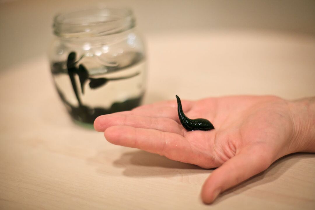Leeches will serve as raw material for the manufacture of a cream that stimulates penis growth